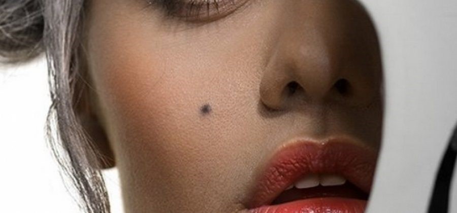 Метки дьявола или бога. Мистика, которую несут ваши родинки